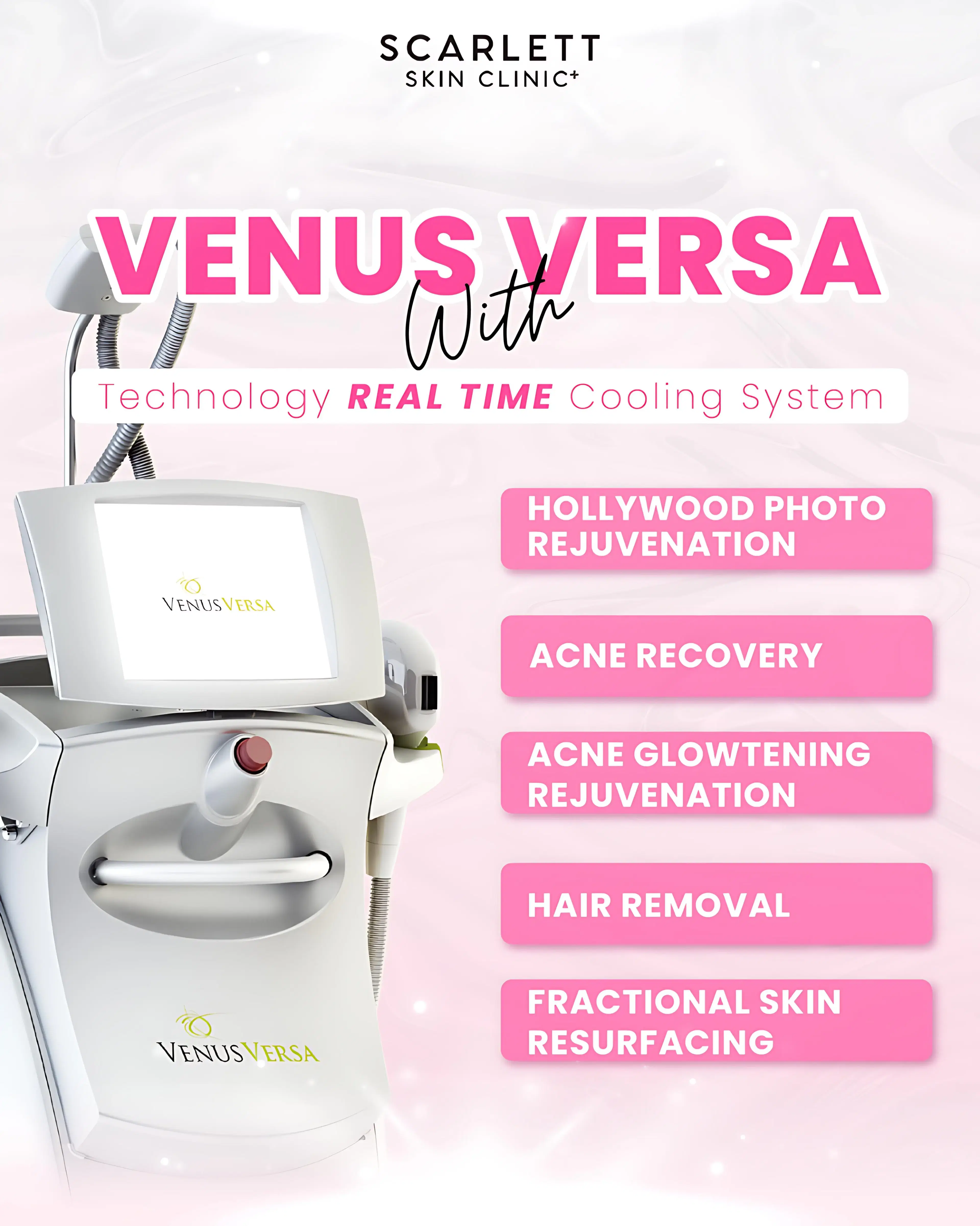 Venus