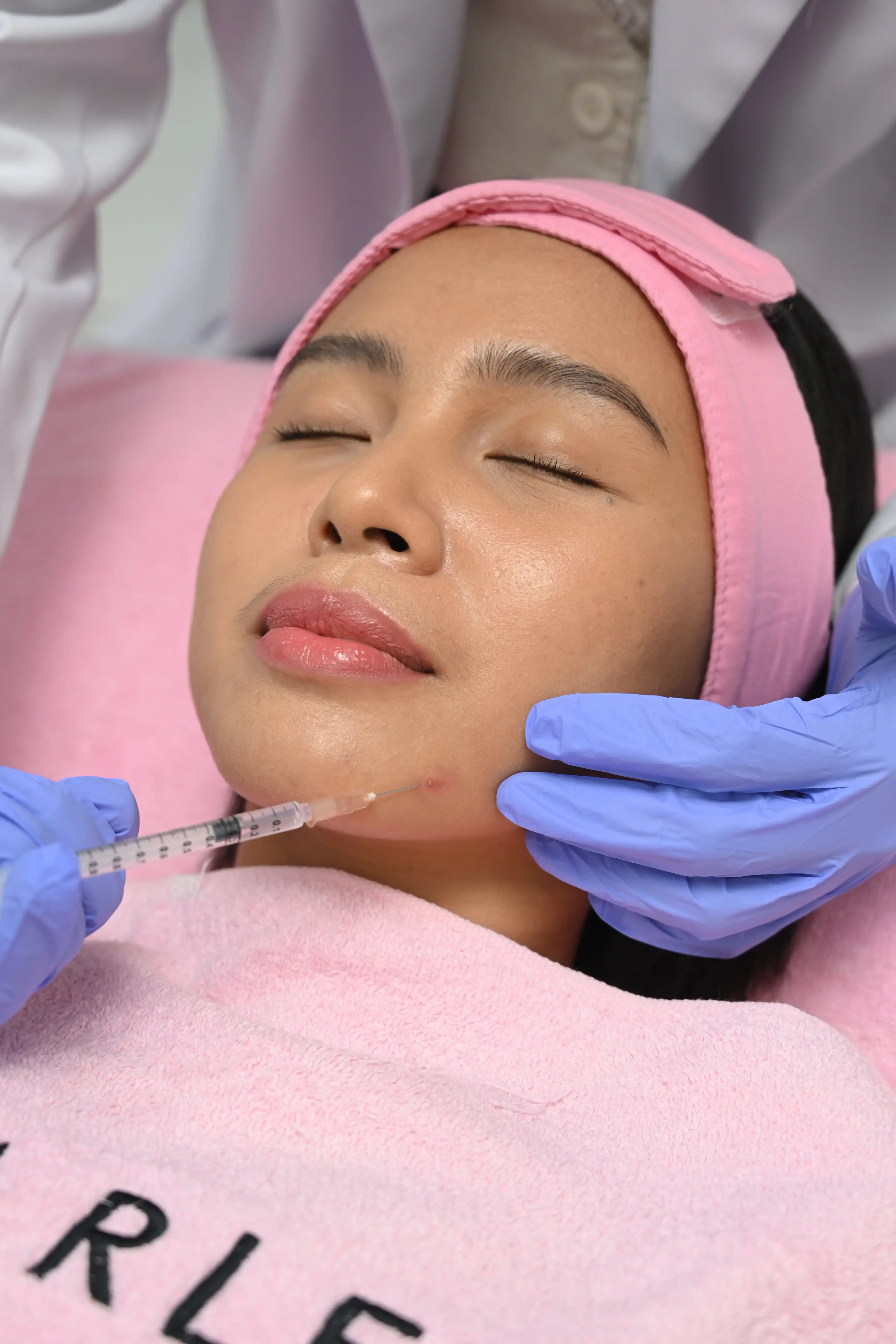 Acne Spot Injection treatment