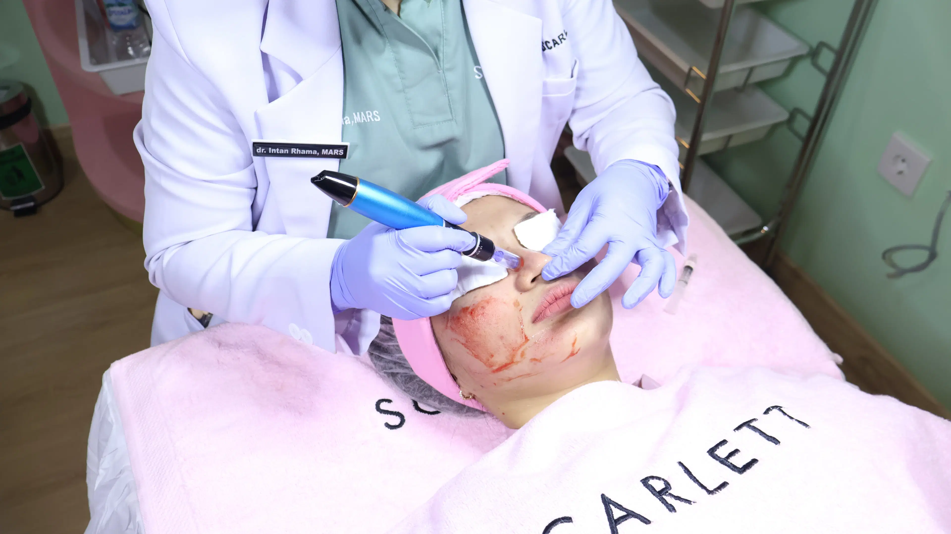 Dermapen Exosome Treatment treatment