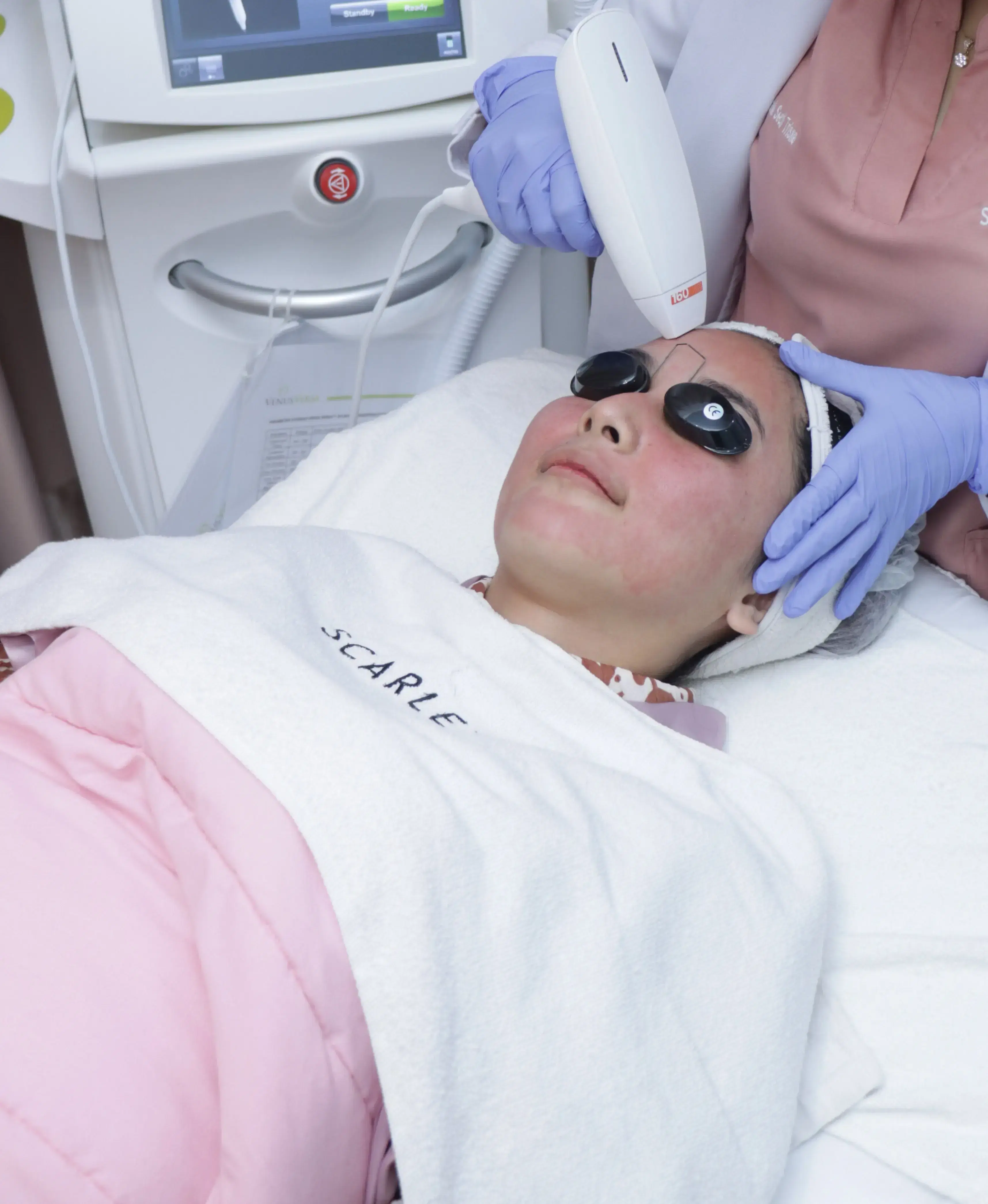 Fractional Skin Resurfacing treatment