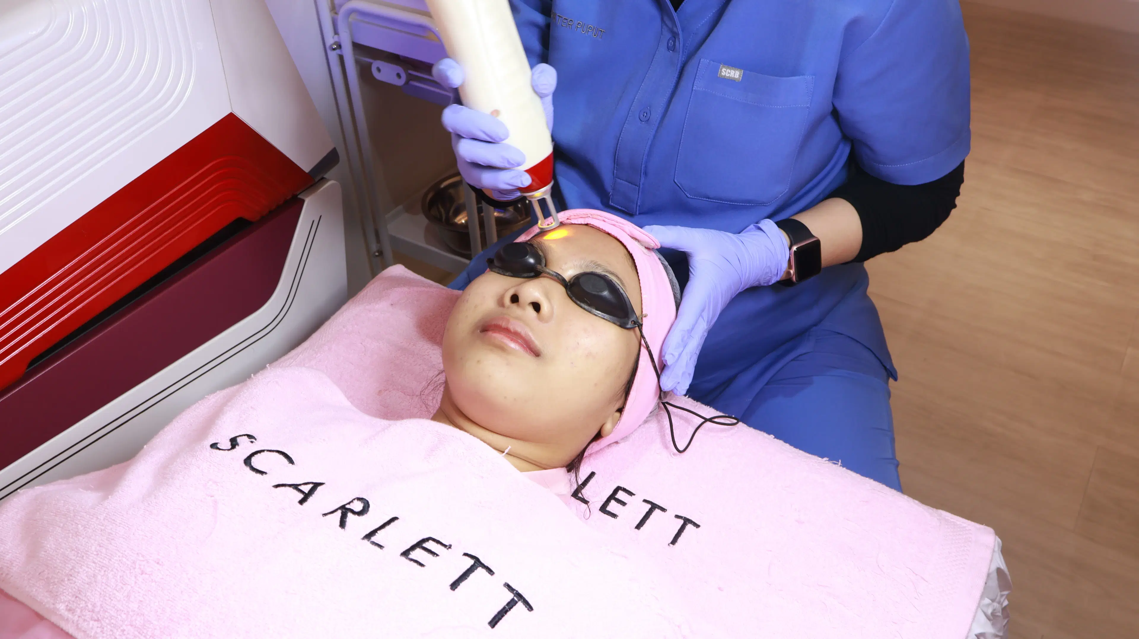 Melasma C-Plus Laser treatment