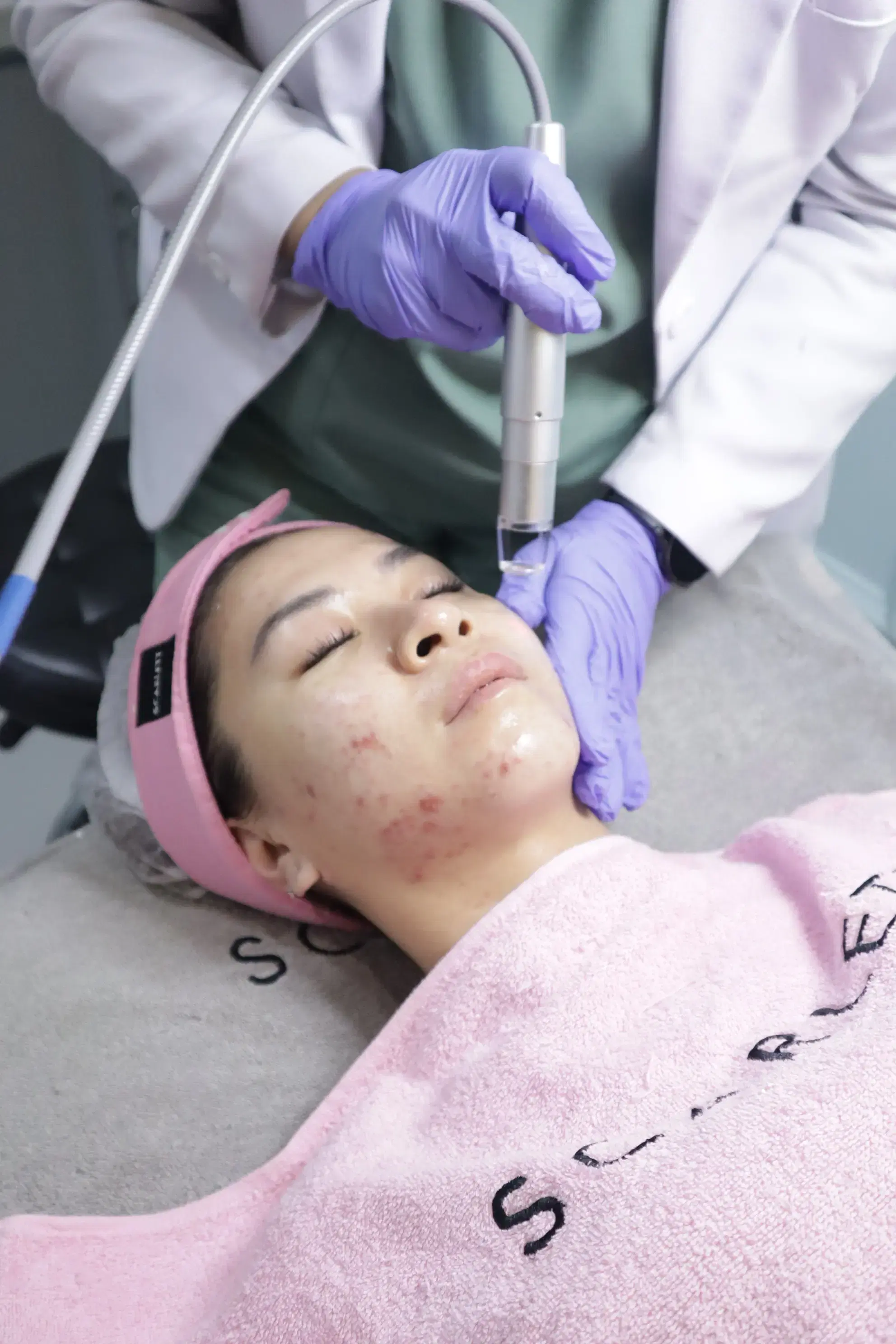 Pore Minimizing A-Plus Laser treatment