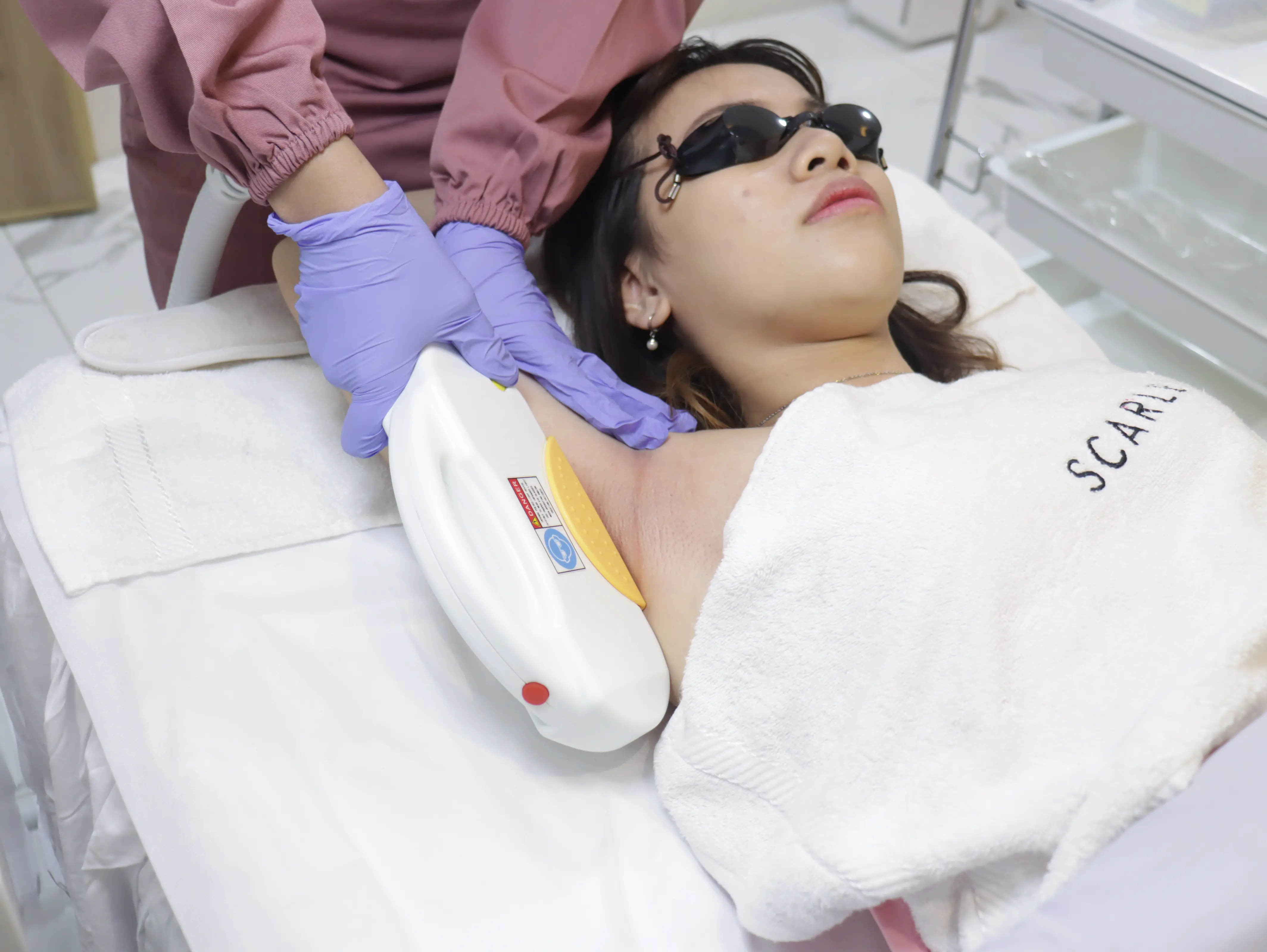 underarm-hair-removal-i2pl-1.webp
